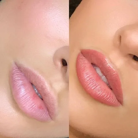 Lip blush result