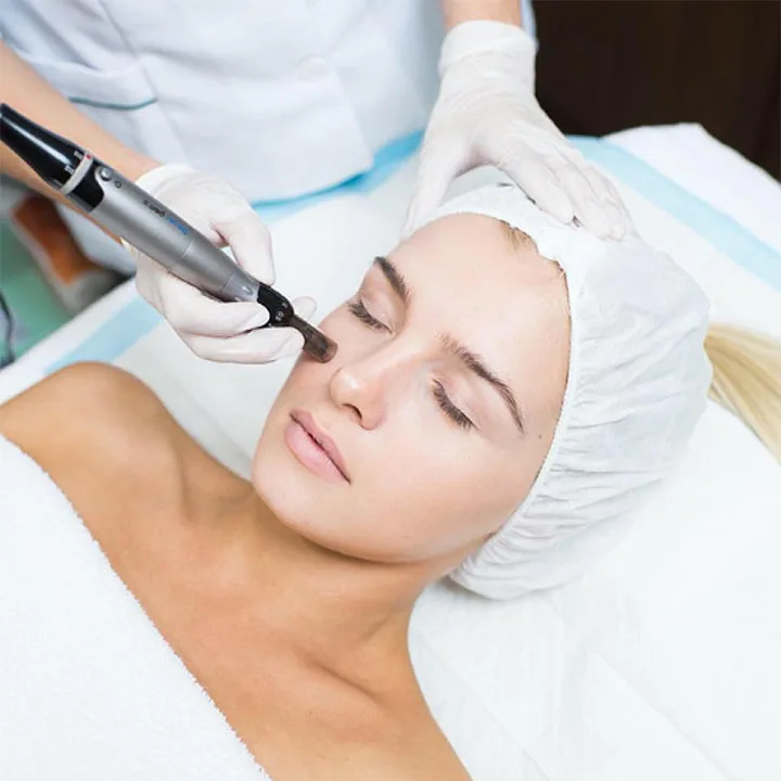 Micro-needling